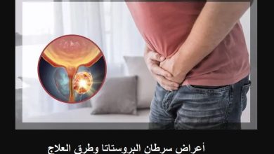 أعراض سرطان البروستاتا وطرق العلاج